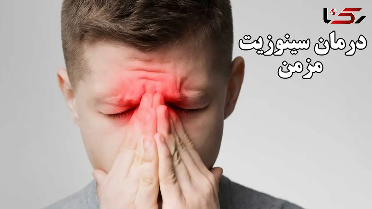 درمان سینوزیت مزمن