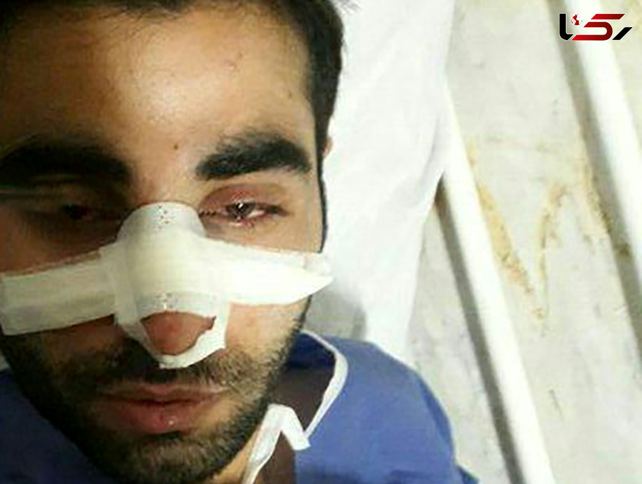 ضرب و شتم وحشیانه پرستار بیمارستان امام خمینی(ره) اردبیل + عکس
