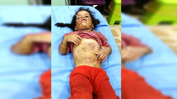 این 2 دختر تا حد مرگ شکنجه شدند +عکس