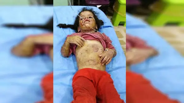 این 2 دختر تا حد مرگ شکنجه شدند +عکس