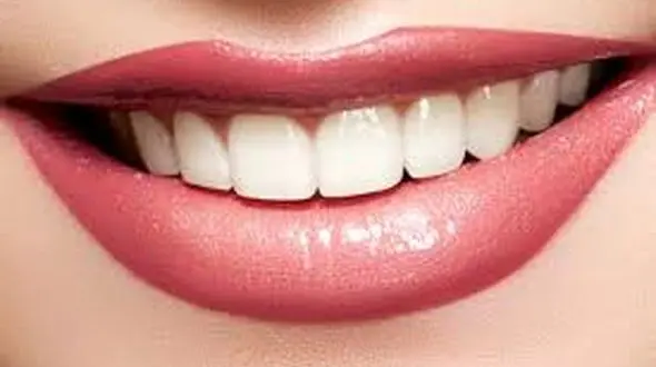 درمان لکه های سفید دندان/زیبایی تان را دو برابر کنید
