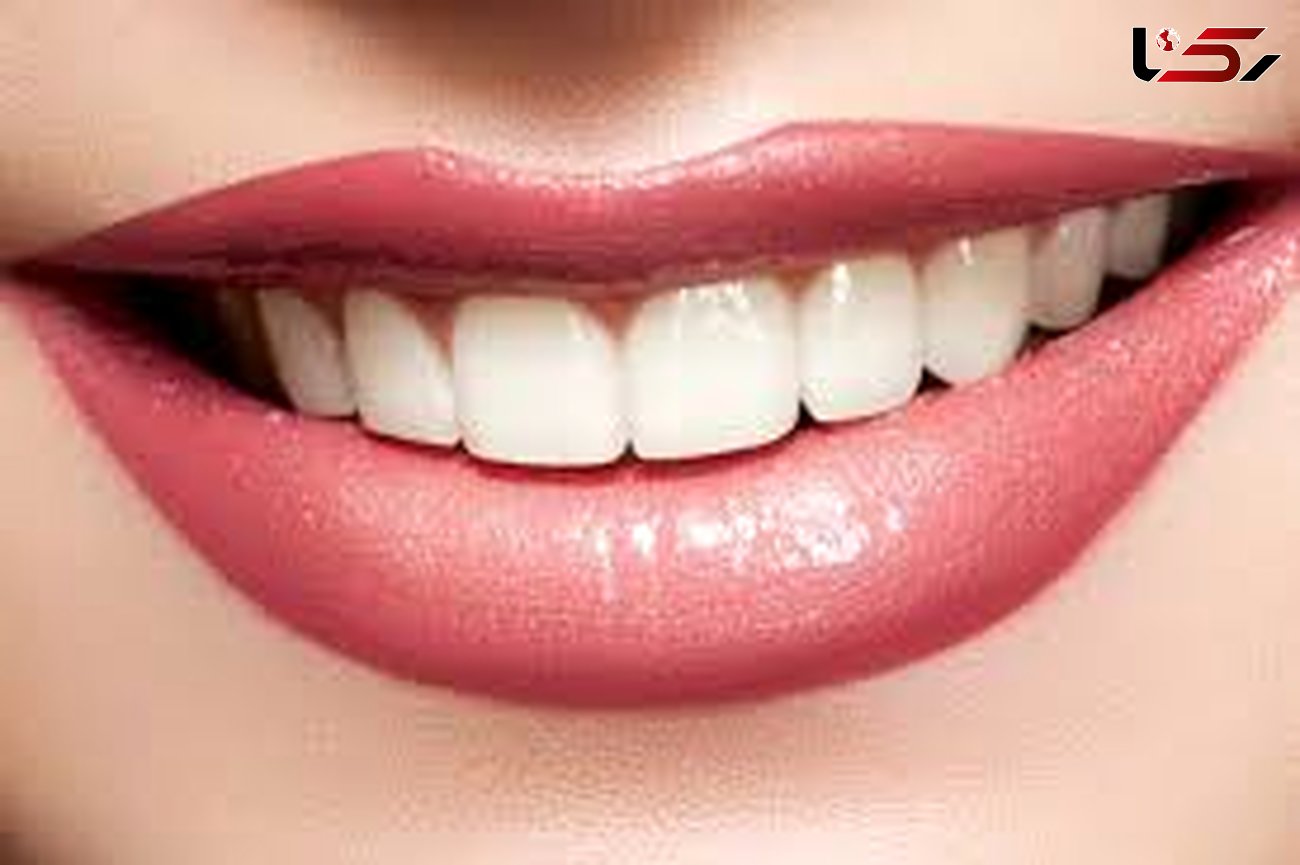 درمان لکه های سفید دندان/زیبایی تان را دو برابر کنید