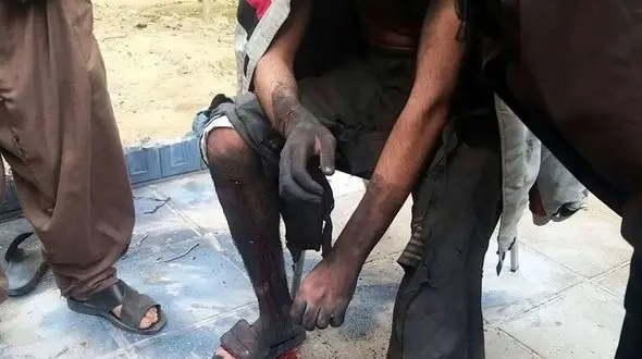 انفجار مواد محترقه در دست نوجوان 16ساله تهرانی