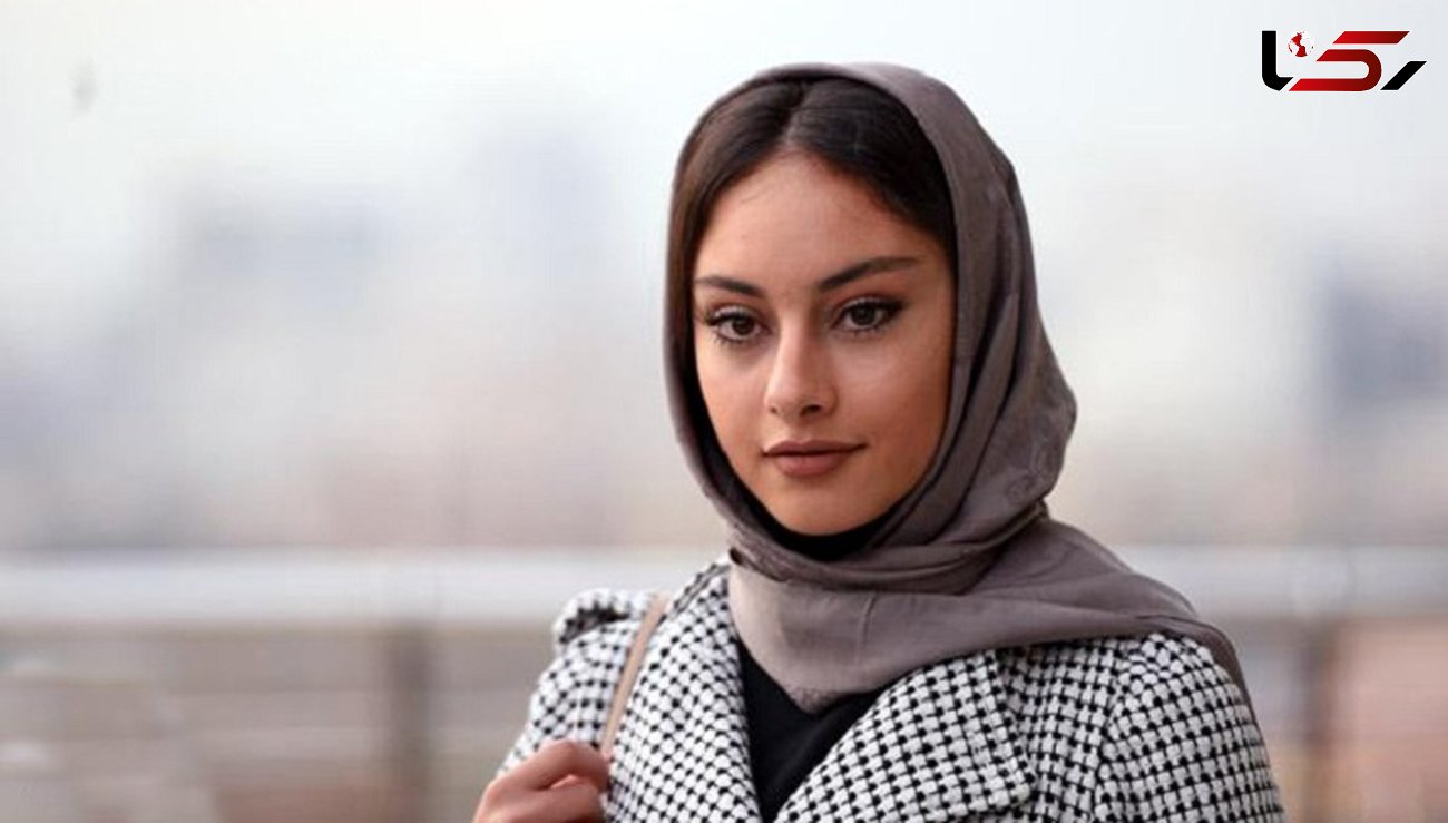 عکس تغییر بزرگ چهره زیباترین خانم بازیگر ایرانی ! 