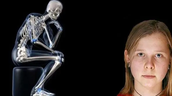 اشعه ایکس از چشمان این دختر می بارد + عکس 