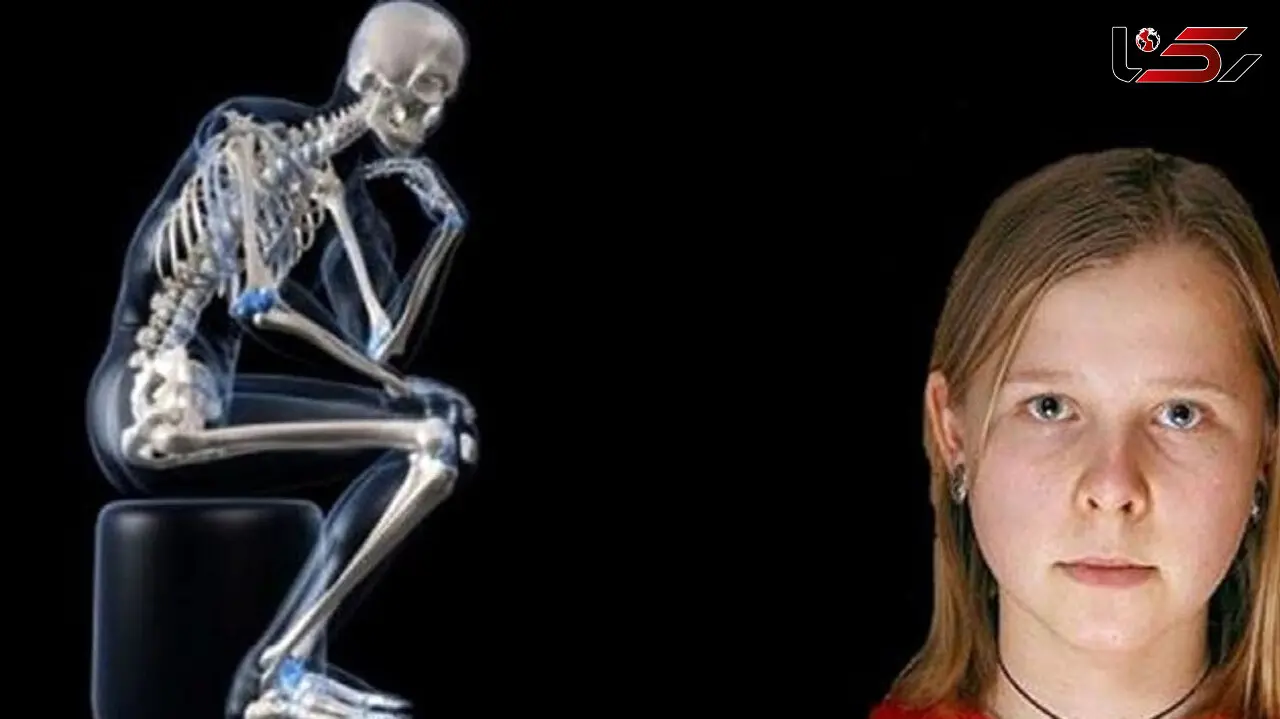 اشعه ایکس از چشمان این دختر می بارد + عکس 