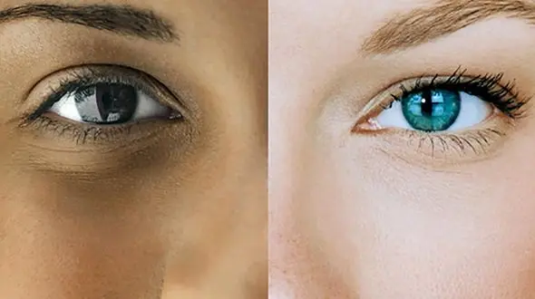 نقش یک ویتامین در تفاوت رنگ پوست انسان ها