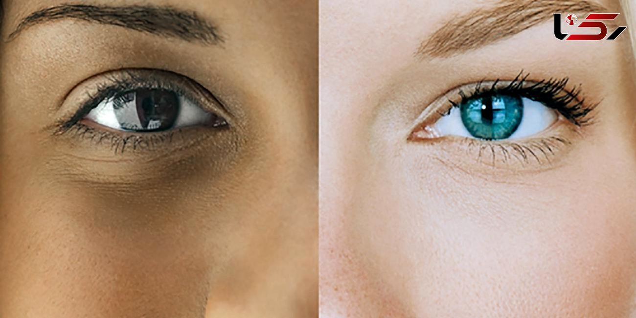 نقش یک ویتامین در تفاوت رنگ پوست انسان ها