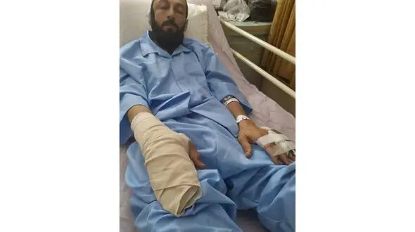 حمله خونین با میله آهنی به 2 روحانی در قم + عکس