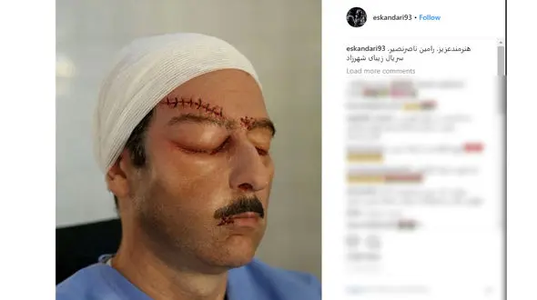 عکس گریم خودکشی هوشنگ در سریال شهرزاد لو رفت 