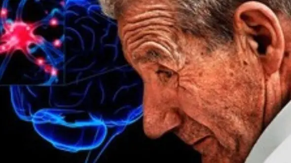 نخستین نشانه بیماری  پارکینسون را بشناسید