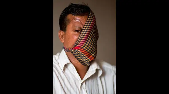 صورت این مرد توسط ببر وحشی خورده شد +عکس