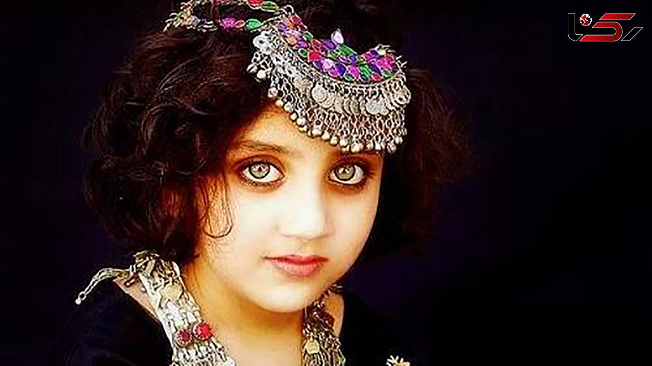 این دختربچه‌ زیباترین چشم‌های دنیا را دارد +عکس