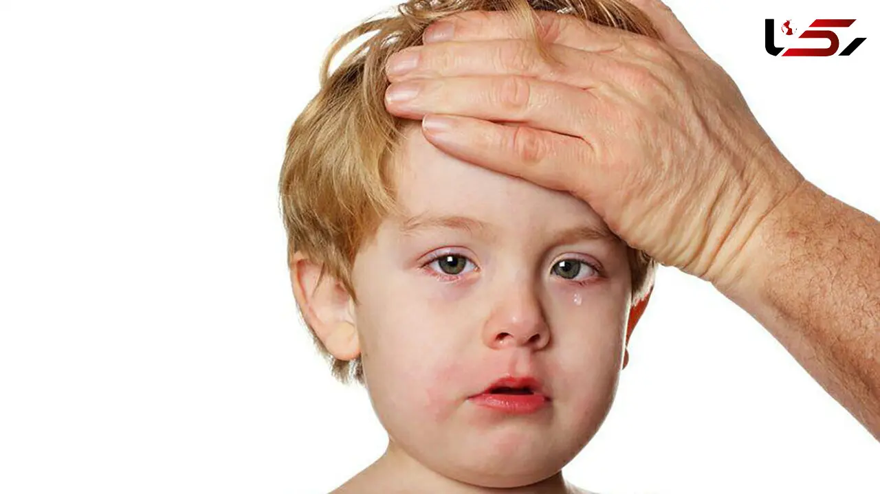 همه چیز درباره سندروم کاوازاکی