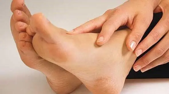 درمان های فوری برای مقابله با خار پاشنه