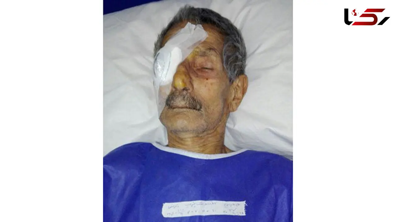 عمل جراحی چشم راست یک بیمار به جای چشم چپ او در نوشهرجنجال به پا کرد!+عکس