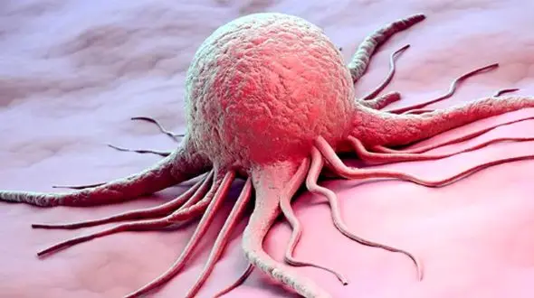 تنها یک کار برای پیشگیری از 20 نوع سرطان کافی است!