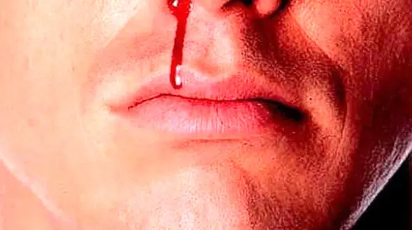 درگیری عجیب و خونین زن و شوهر به خاطر ورود یک موش به اتاق خواب ! 