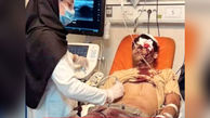 کور شدن چشم پسرجوان در پی حمله اراذل و اوباش + عکس