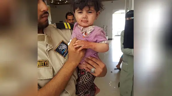 این کودک یمنی تنها بازمانده یک خانواده در بمباران سعودی ها است + عکس تلخ