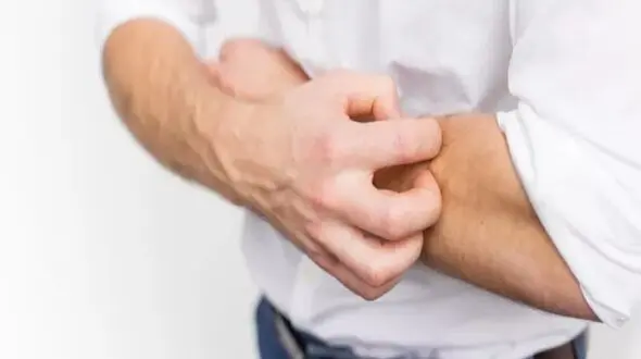 نسخه ای طلایی برای مقابله با خارش پوستی