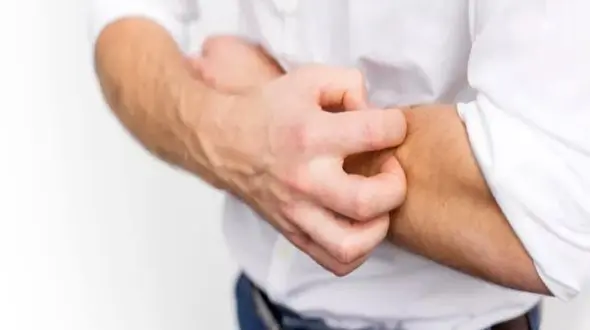 نسخه ای طلایی برای مقابله با خارش پوستی