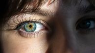 عمل تغییر رنگ چشم فقط برای روش درمانی مجاز است/ سابلیمینال چشم یک روش کلاهبرداری است