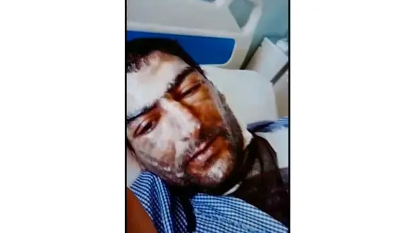 ترسناک ترین فیلم از اسیدپاشی در تبریز / وحشت دختربچه دوچرخه سوار!  + عکس و جزییات