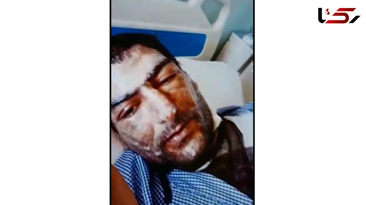 ترسناک ترین فیلم از اسیدپاشی در تبریز / وحشت دختربچه دوچرخه سوار!  + عکس و جزییات