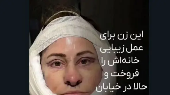 زنی که به خاطر زیبا شدن کارتن خواب شد + عکس