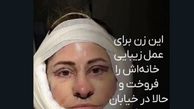 زنی که به خاطر زیبا شدن کارتن خواب شد + عکس