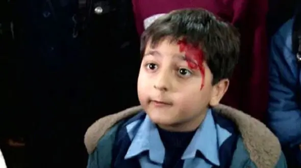 تغییر چهره کودک نقش «پوریا» سریال دودکش بعد 11 سال در 18 سالگی