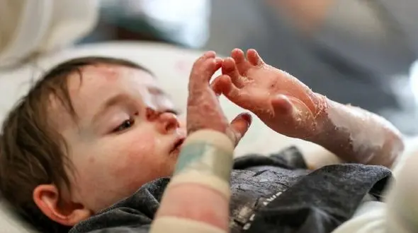 سودجویی برخی آزمایشگاه ها از بیماران پروانه ای / یک آزمایش پرریسک، 15 میلیون تومان 