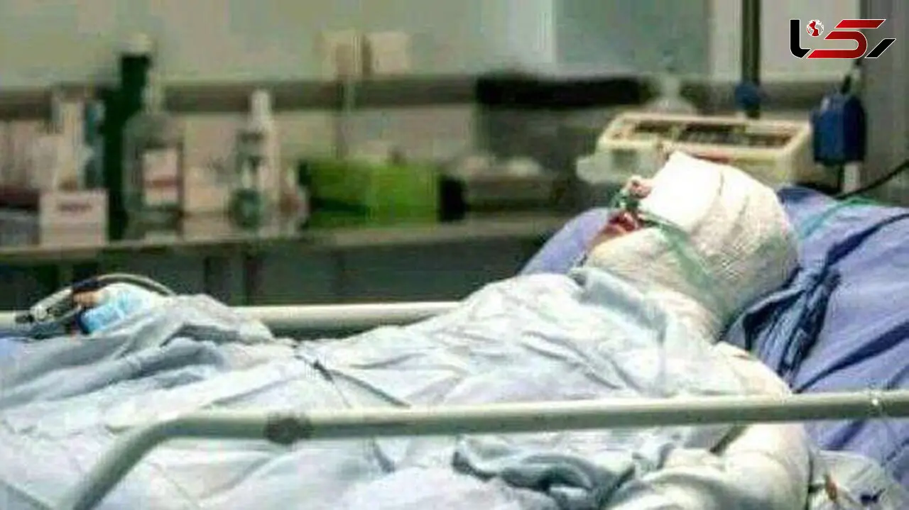  احتمال  کرونا در افراد دچار سوختگی بیشتر است.