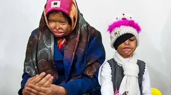 رعنا 9 ساله اعدام مرد بی رحم را خواست و ..! +عکس 