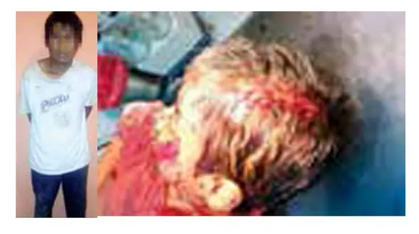 مجروح شدن پسر 3 ساله در دفاع از مادر+عکس