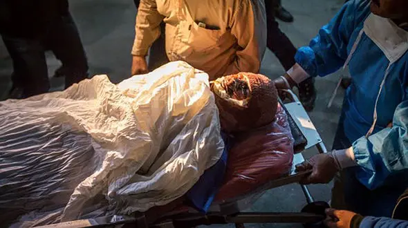 131 ایرانی شب گذشته قطع عضو شدند