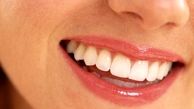  تغییر رنگ دندان‌ها چه دلایلی دارد؟