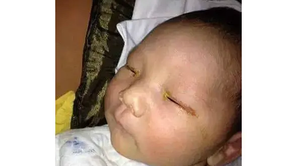 یک نوزاد با فلش دوربین کور شد!+عکس 