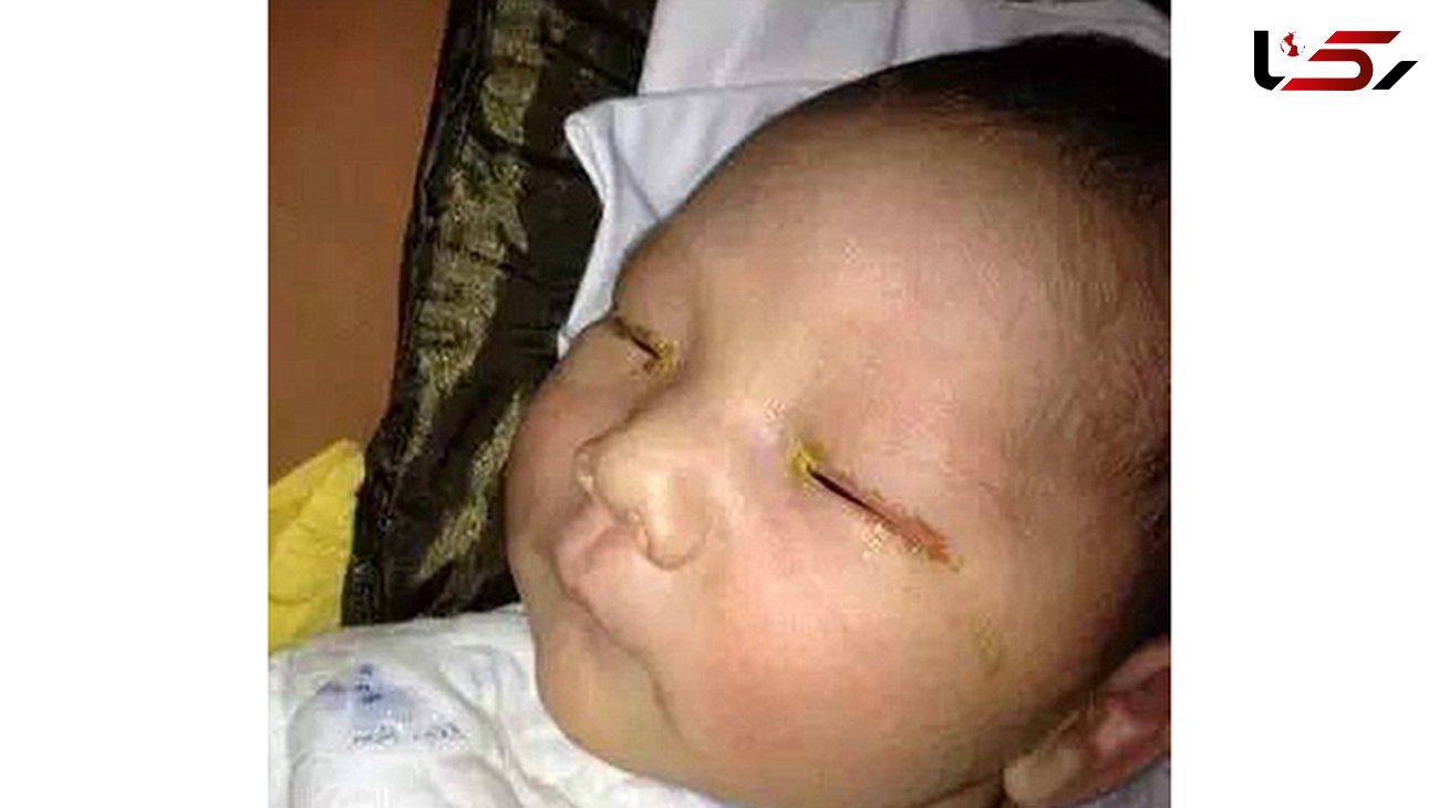 یک نوزاد با فلش دوربین کور شد!+عکس 
