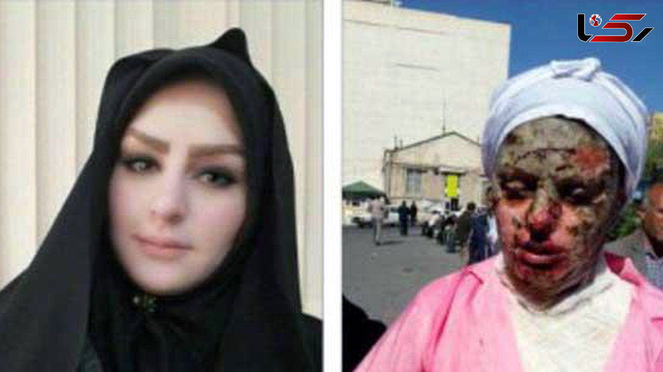 پرونده 5 اسیدپاشی پی در پی در تبریز + عکس