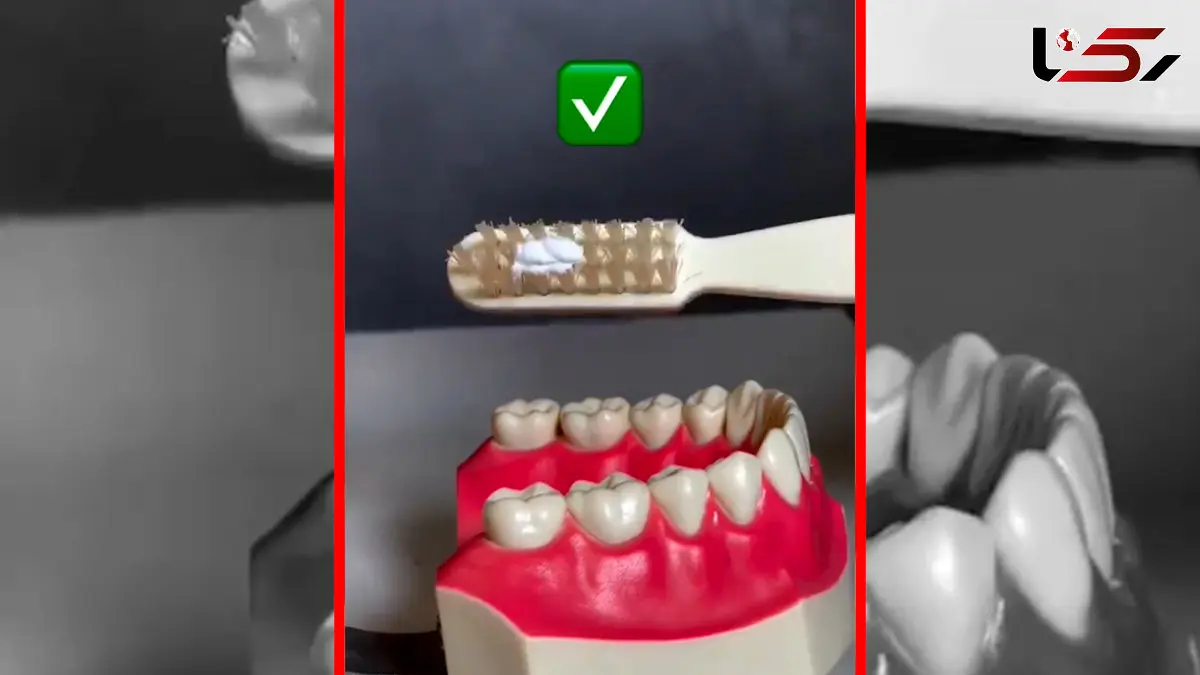 فیلم تکنیک های مسواک زدن صحیح