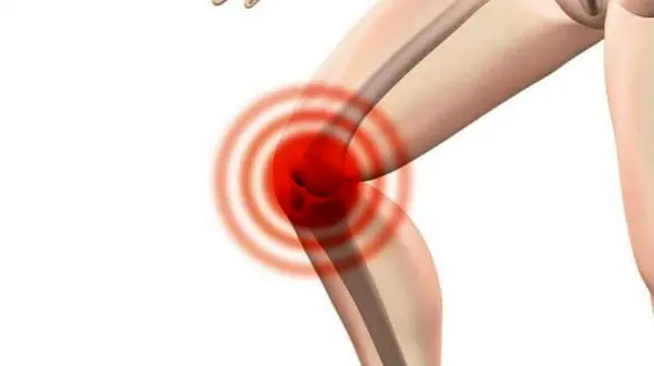 چرا زانو تق تق می کند؟ راه های درمان آن چیست؟