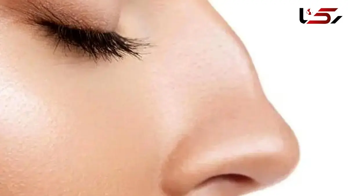 چرا قوز بینی به ترند زیبایی سال 2026 تبدیل شده است؟