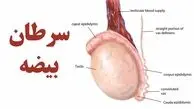 آقایان بخوانند / 7 نشانه مهم سرطان بیضه