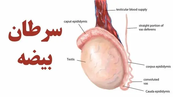 آقایان بخوانند / 7 نشانه مهم سرطان بیضه