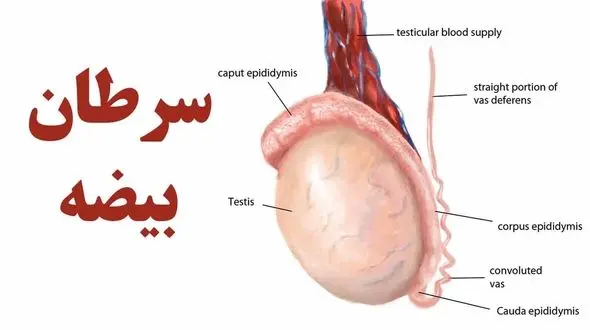 آقایان بخوانند / 7 نشانه مهم سرطان بیضه