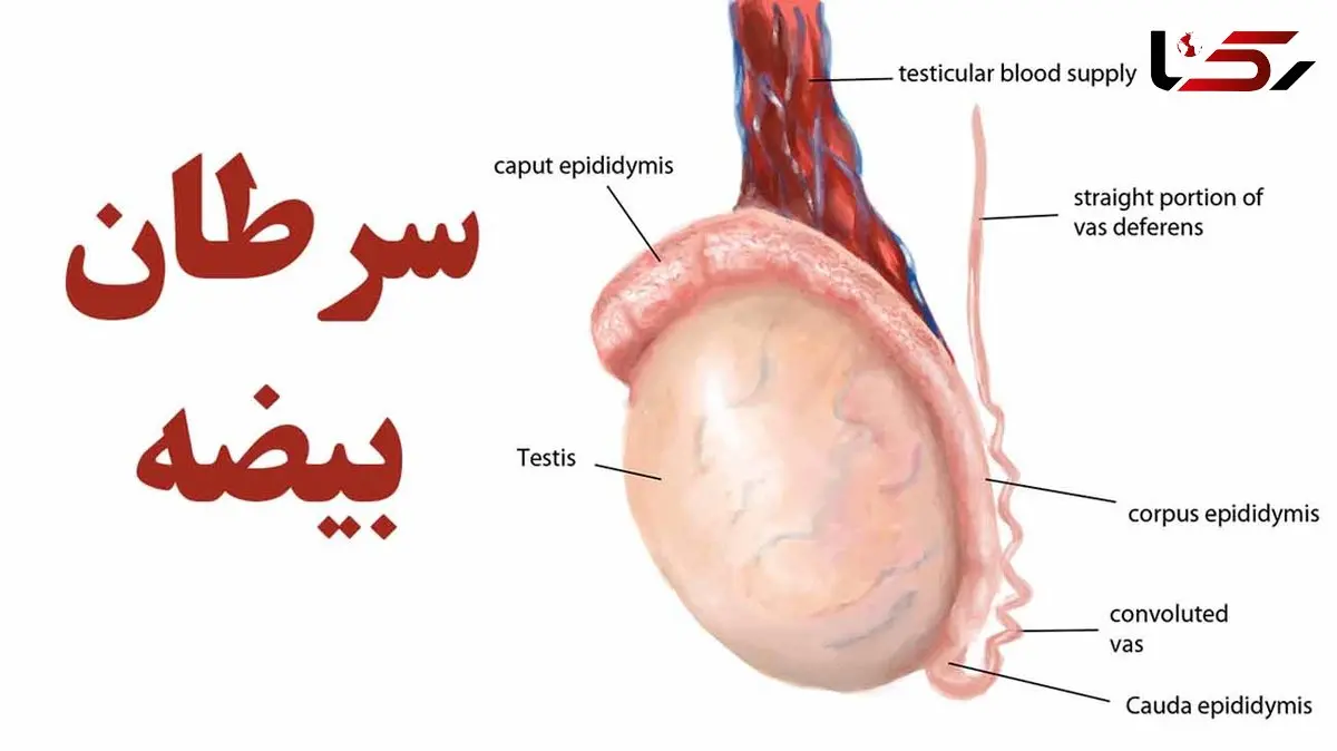 آقایان بخوانند / 7 نشانه مهم سرطان بیضه