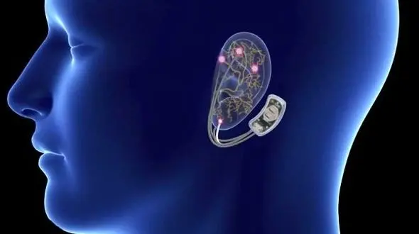  ترک اعتیاد با کمک این تراشه مغزی