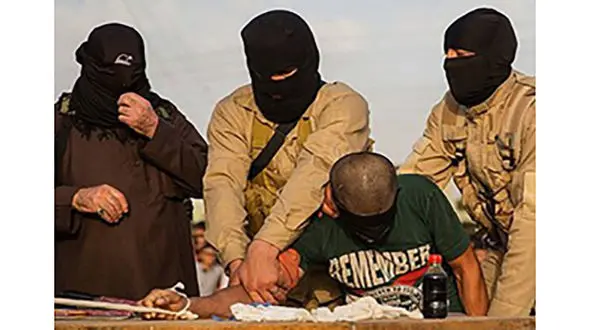 بدون بی حسی نامردها دستم را قطع کردند!+عکس 